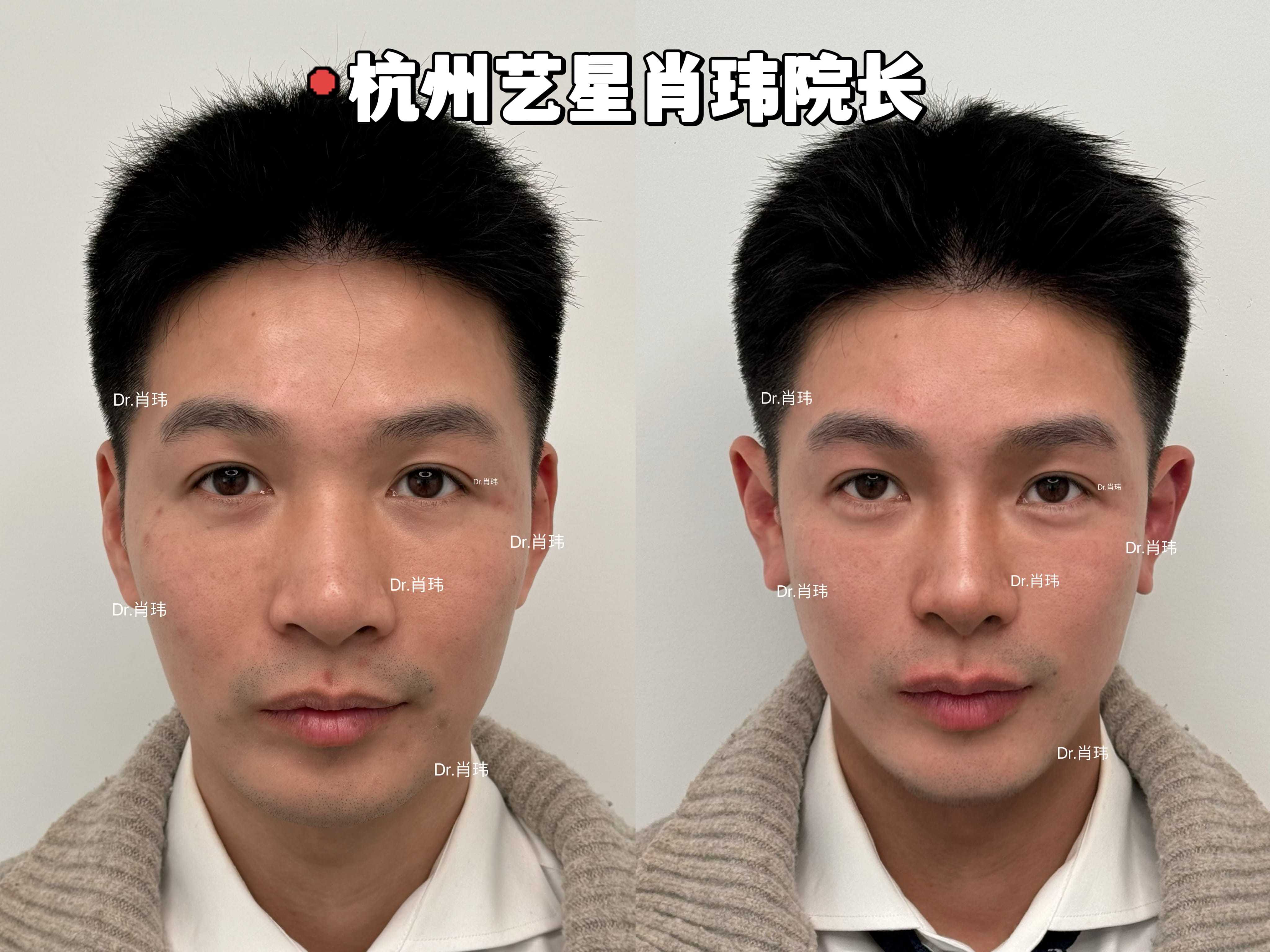 男生脸部变帅的方法,男生脸部变帅的方法小学生长脸