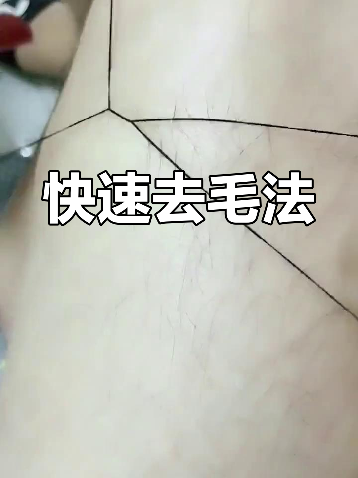 女生去小胡子的小妙招,女生去小胡子的小妙招哪个最有效