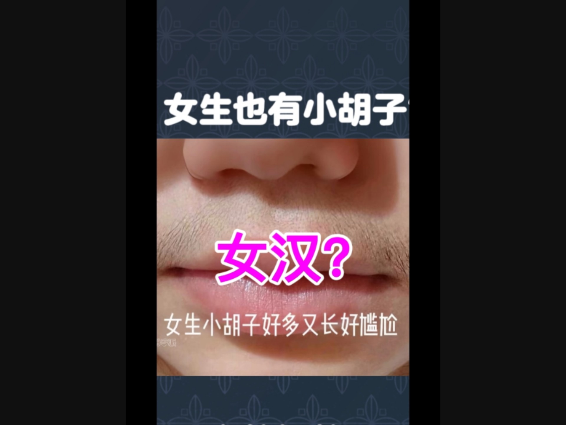 女生去小胡子的小妙招,女生去小胡子的小妙招哪个最有效