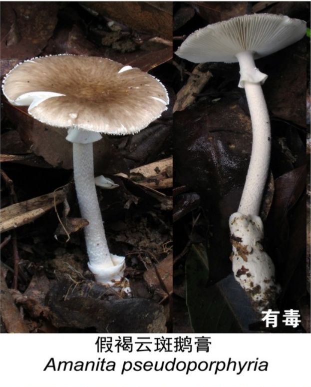porphyria,Porphyrias
