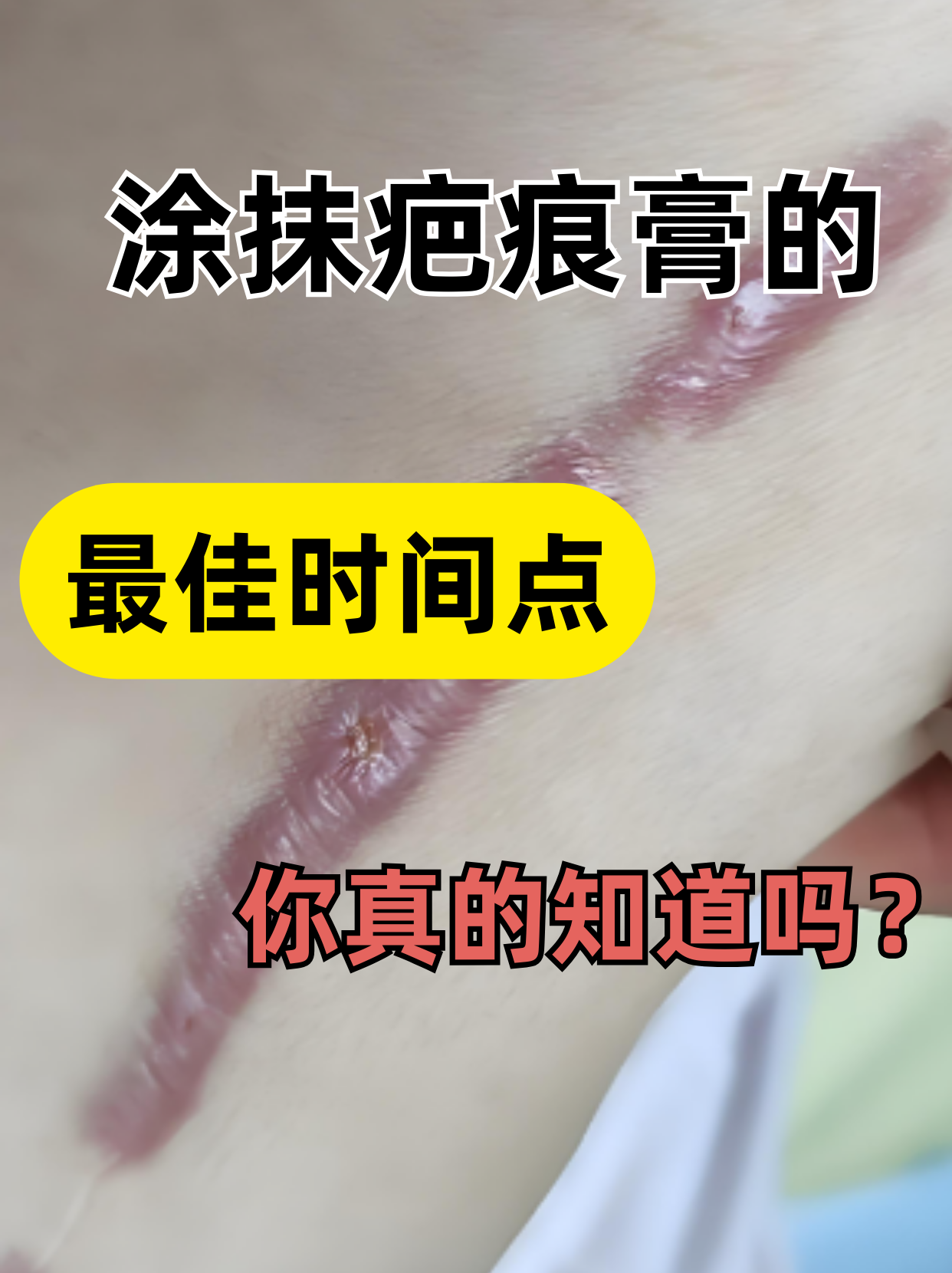 疮疤的拼音,憎恶的两个读音