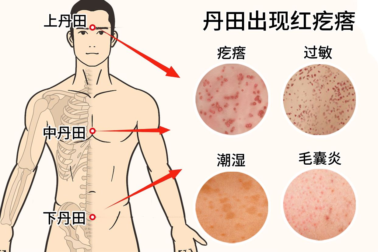 疙瘩的意思,疙瘩的意思语文